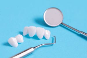 A large and small dental bridge next to dental tools